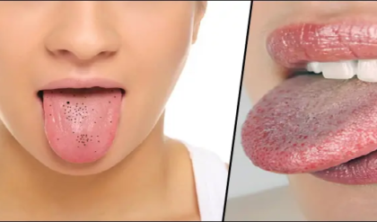 কথা বলতে লজ্জা পাচ্ছেন? জিহ্বার কালো দাগ দূর হবে নিমেষেই; ঘরোয়া এই পদ্ধতিগুলো কি জানতেন?