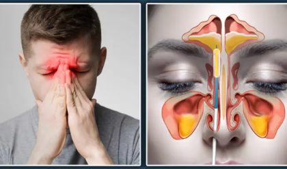 অপারেশন নয়, সাইনাস থেকে মুক্তি মিলবে বাড়িতেই! জেনে নিন ৫টি ম্যাজিক্যাল উপায়