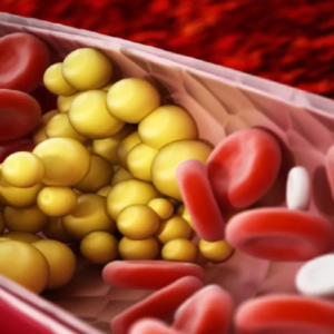 রক্তে কোলেস্টেরল বাড়ছে? ওষুধ ছাড়াই মাত্র ১ মাসে লিপিড প্রোফাইল স্বাভাবিক করার ৫টি সিক্রেট উপায়