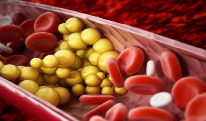 রক্তে কোলেস্টেরল বাড়ছে? ওষুধ ছাড়াই মাত্র ১ মাসে লিপিড প্রোফাইল স্বাভাবিক করার ৫টি সিক্রেট উপায়