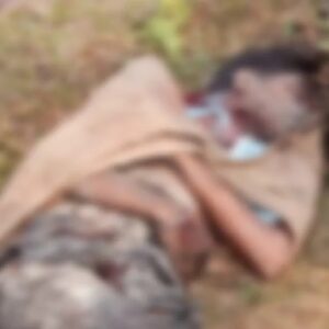 মর্টার শেল পোড়াতে গিয়ে ছিন্নভিন্ন কিশোর! মালবাজারে তিস্তা নদীর চরে ভয়াবহ বিস্ফোরণ