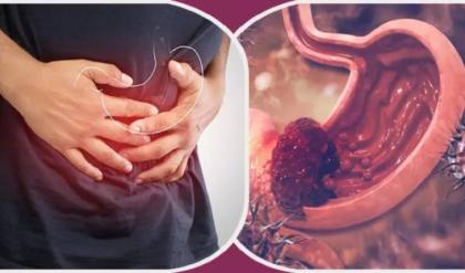 বারবার পেটে ব্যথা ও মলত্যাগের অভ্যাসে পরিবর্তন? অবহেলা করলে বড় বিপদ, জানুন ক্যান্সারের লক্ষণ