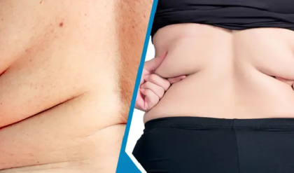 মেদহীন পিঠ পেতে চান? জিম ছাড়াই বাড়িতে ট্রাই করুন এই ৩টি কার্যকরী উপায়