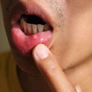 অবহেলা করলেই বিপদ! মুখের ভেতরে এই পরিবর্তনগুলো দেখলেই আজই চিকিৎসকের কাছে যান