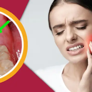 আক্কেল দাঁতের ব্যথায় প্রাণ ওষ্ঠাগত? ডেন্টিস্টের কাছে যাওয়ার আগে ট্রাই করুন এই ৪টি ম্যাজিক ঘরোয়া টোটকা