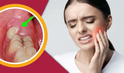 আক্কেল দাঁতের ব্যথায় প্রাণ ওষ্ঠাগত? ডেন্টিস্টের কাছে যাওয়ার আগে ট্রাই করুন এই ৪টি ম্যাজিক ঘরোয়া টোটকা