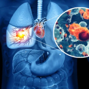 ফুসফুসের ক্যান্সারের নিশানায় কি পুরুষরাই বেশি? চিকিৎসকদের নতুন গবেষণায় উঠে এলো ভয়ংকর তথ্য