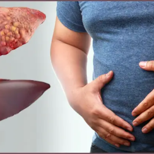 আপনার লিভার কি ঠিকঠাক কাজ করছে? এই ৫টি লক্ষণ দেখলেই আজই সাবধান হোন, নাহলে বিপদ