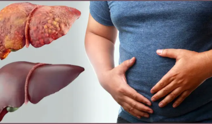 আপনার লিভার কি ঠিকঠাক কাজ করছে? এই ৫টি লক্ষণ দেখলেই আজই সাবধান হোন, নাহলে বিপদ