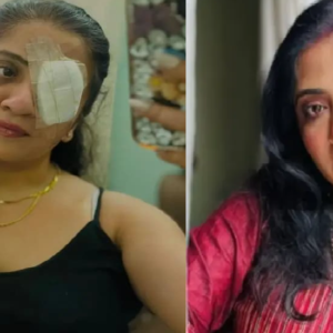 ‘পুরস্কার না কি শাস্তি?’ ব্যান্ডেজ বাঁধা চোখে ছবি পোস্ট ‘মিলন হবে কতদিনে’ খ্যাত অভিনেত্রীর, স্টুডিও পাড়ায় শোরগোল