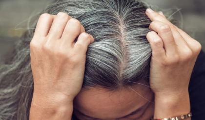 অল্প বয়সেই চুলে পাক? বড় কোনো রোগের আগাম সংকেত নয়তো? আসল সত্যিটা জানুন!