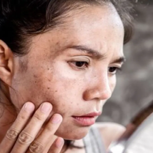 বসন্তের হাওয়ায় ত্বক কি রুক্ষ হয়ে যাচ্ছে? এই ৩টি ভুল করলেই হারাবেন গ্ল্যামার!