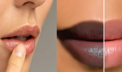 লিপস্টিক নয়, জেল্লা ফিরুক প্রাকৃতিকভাবেই! জেদি দাগ দূর করার সহজ উপায় জানুন