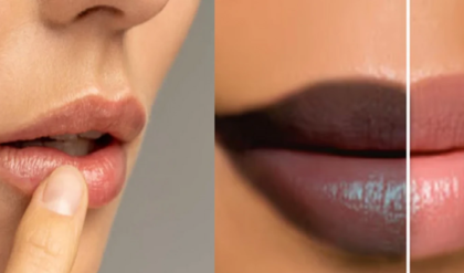 লিপস্টিক দিয়ে আর ঢাকতে হবে না কালো দাগ! ঘরোয়া ম্যাজিকেই ফিরবে ঠোঁটের পাশের হারানো জেল্লা