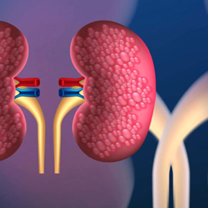 কিডনি বিকল হওয়ার আগে শরীর দেয় এই ৯টি সংকেত! অবহেলা করলেই চিরতরে বিপদ