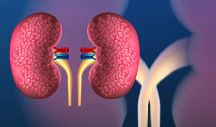 কিডনি বিকল হওয়ার আগে শরীর দেয় এই ৯টি সংকেত! অবহেলা করলেই চিরতরে বিপদ