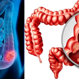 পেটের এই সাধারণ সমস্যাগুলোই কি ক্যান্সারের লক্ষণ? সময় থাকতে চিনে নিন মারণ রোগের সংকেত!