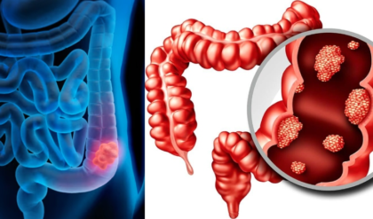 পেটের এই সাধারণ সমস্যাগুলোই কি ক্যান্সারের লক্ষণ? সময় থাকতে চিনে নিন মারণ রোগের সংকেত!