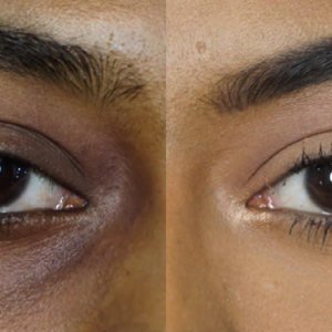 সৌন্দর্যে বাধা হয়ে দাঁড়াচ্ছে চোখের কালি? জেন নিন রাতারাতি মুক্তি পাওয়ার কার্যকরী কৌশল