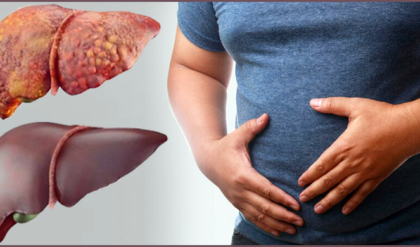 তেতো উচ্ছেই কি লিভারের শত্রু? বিজ্ঞানীদের নতুন তথ্যে চাঞ্চল্য, খাওয়ার আগে সাবধান!