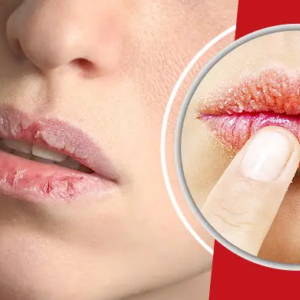 সাবধান! ফাটা ঠোঁটে জিভ দেওয়ার অভ্যাস ডেকে আনছে বড় বিপদ, আজই জানুন সঠিক প্রতিকার