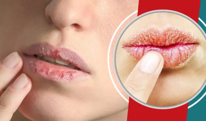সাবধান! ফাটা ঠোঁটে জিভ দেওয়ার অভ্যাস ডেকে আনছে বড় বিপদ, আজই জানুন সঠিক প্রতিকার