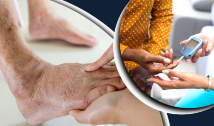 ডায়াবেটিস রোগীদের ওজন কিছুতেই কমছে না? জেনে নিন বাধার মূল ৩টি কারণ