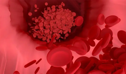 রক্তাল্পতা কি আপনাকে তিলে তিলে শেষ করছে? হিমোগ্লোবিনের ঘাটতি বোঝার ৫টি লক্ষণ ও ঘরোয়া সমাধান