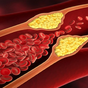 রক্তে জমেছে চর্বি? রোজ সকালে এই ৩টি পানীয় খেলেই গলবে কোলেস্টেরল, বাঁচবে হার্ট!