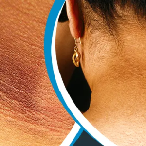 ঘাড় ও গলার জেদি কালো দাগ নিয়ে চিন্তিত? মাত্র ৫ মিনিটে ছেলেদের ত্বক পরিষ্কার করার ম্যাজিক ট্রিকটি দেখে নিন!