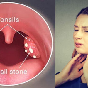 গলায় মারাত্মক ব্যথা? টনসিলকে বিদায় জানান এই ঘরোয়া ম্যাজিকে, মিলবে নিমেষেই আরাম!
