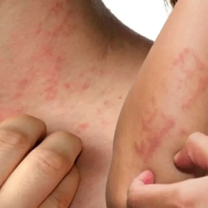 ধুলোবালিতেই হাঁচি-কাশি আর শ্বাসকষ্ট? পকেটভর্তি ওষুধ নয়, ঘরোয়া এই ৫ টোটকাতেই মিলবে মুক্তি!