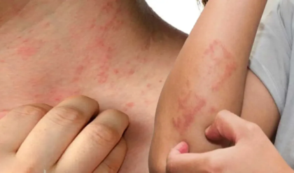 ধুলোবালিতেই হাঁচি-কাশি আর শ্বাসকষ্ট? পকেটভর্তি ওষুধ নয়, ঘরোয়া এই ৫ টোটকাতেই মিলবে মুক্তি!