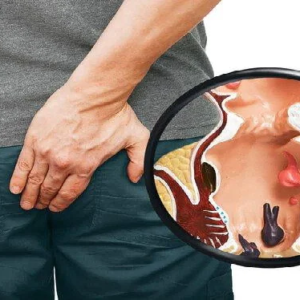 পাইলসের যন্ত্রণায় রাতের ঘুম হারাম? এই ৫ খাবারেই লুকিয়ে আছে ম্যাজিক সমাধান