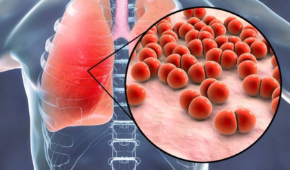 নিঃশব্দে থাবা বসাচ্ছে নিউমোনিয়া! সামান্য সর্দি-কাশি না কি প্রাণঘাতী সংক্রমণ? চিনে নিন লক্ষণ