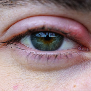 চোখে বারবার অঞ্জনি হচ্ছে? ঘরোয়া এই টোটকাতেই মিলবে ম্যাজিক আরাম, জানুন চিকিৎসকদের পরামর্শ