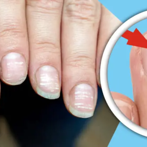 নখের সাদা দাগ কি কোনো মরণব্যাধির সংকেত? অবহেলা করলে পস্তাতে হতে পারে, জানুন আসল কারণ!