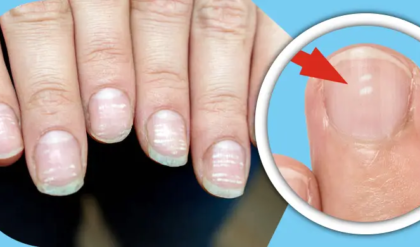 নখের সাদা দাগ কি কোনো মরণব্যাধির সংকেত? অবহেলা করলে পস্তাতে হতে পারে, জানুন আসল কারণ!