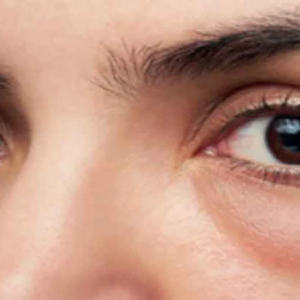 আয়নার সামনে দাঁড়াতে ভয়? চোখের নিচের ফোলাভাব দূর হবে মাত্র ৫ মিনিটে!