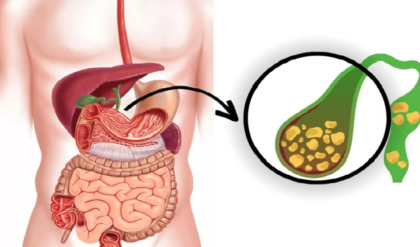 পেটে অসহ্য ব্যথা? পিত্তথলিতে পাথর জমার এই মূল কারণগুলো জানলে চমকে যাবেন!