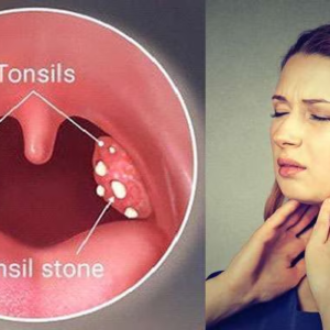 টনসিলের তীব্র যন্ত্রণায় অস্থির? ঘরোয়া উপায়েই মিলবে মুক্তি!