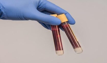 রক্তের রং সোনালি? বিশ্বের মাত্র ৪৩ জনের শরীরে বইছে এই ‘গোল্ডেন ব্লাড’, আপনি নেই তো তালিকায়?