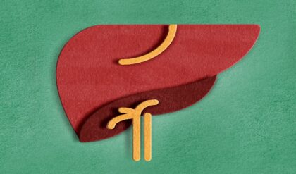 ১০ জনে ৪ জনই ফ্যাটি লিভারে আক্রান্ত! শুধু মদ্যপান নয়, সুস্থ থাকতে এখনই বর্জন করুন এই সাধারণ ভুলগুলো