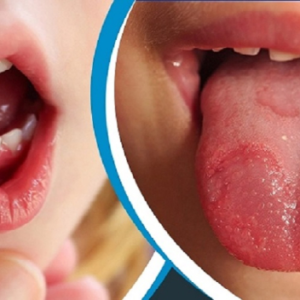 মুখের ঘায়ের যন্ত্রণায় খাওয়া-দাওয়া বন্ধ? এক রাতেই ম্যাজিকের মতো কাজ করবে এই ঘরোয়া টোটকা!