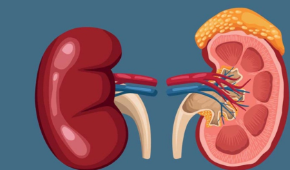 সাবধান! কিডনি বিকল হওয়ার এই সংকেতগুলো অবহেলা করছেন না তো? বিপদ আসার আগেই জানুন সাবধান! কিডনি বিকল হওয়ার এই সংকেতগুলো অবহেলা করছেন না তো? বিপদ আসার আগেই জানুন