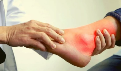 হাড়ের জয়েন্টে অসহ্য ব্যথা? রক্তে ইউরিক অ্যাসিড বাড়ছে না তো? এই ৫টি লক্ষণ দেখলেই সাবধান!