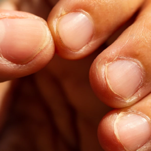 সাবধান! দাঁত দিয়ে নখ কাটেন? অজান্তেই ডেকে আনছেন পঙ্গুত্ব, বাদ যেতে পারে আঙুল!