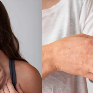 তীব্র গরমে ঘামাচি ও র‍্যাশের যন্ত্রণায় ছটফট করছেন? ঘরোয়া এই ম্যাজিক টোটকায় মুক্তি মিলবে মাত্র ১০ মিনিটে!