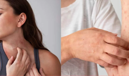 তীব্র গরমে ঘামাচি ও র‍্যাশের যন্ত্রণায় ছটফট করছেন? ঘরোয়া এই ম্যাজিক টোটকায় মুক্তি মিলবে মাত্র ১০ মিনিটে!