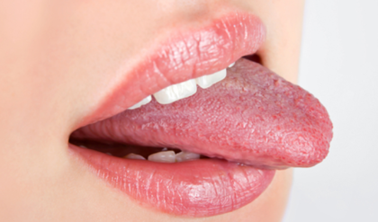 জিভের রঙ কি বদলে যাচ্ছে? সাবধান! আপনার অজান্তেই শরীরে বাসা বাঁধছে এই ৫টি মারণ রোগ